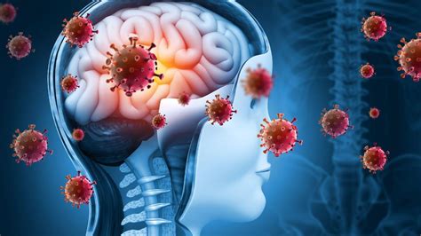 Pneumococcal fulminant meningitis: symptoms, causes and remedies ...