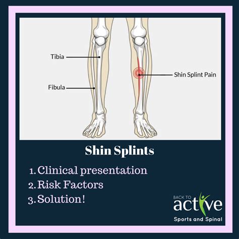 Shin Splints - Back to Active Sports and Spinal - Macquarie Park