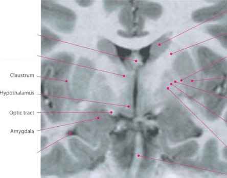 It - Brain Anatomy - European Medical Alliance