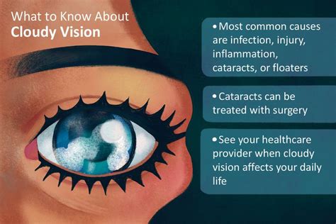 Cloudy Vision in One Eye: Common and Rare Causes