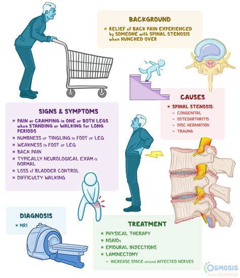 Shopping Cart Sign: What Is It, What It Means, and More | Osmosis