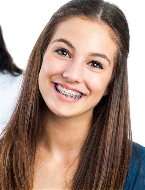 Braces for Adults | Orthodontist Ottawa ON | Centrepointe Orthodontics