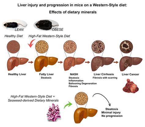 Mineral health supplement could halt fatty liver disease development ...