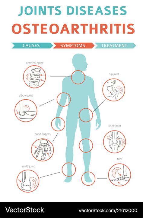 Joints diseases arthritis osteoarthritis symptoms Vector Image