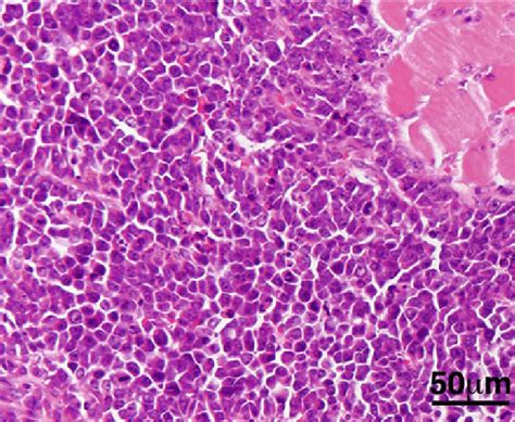 Histology of mouse Ewing sarcoma. Typical small round cell morphology ...