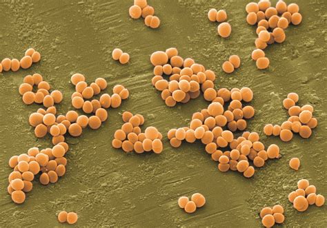 Descubierto el punto débil de la bacteria "Staphylococcus aureus ...