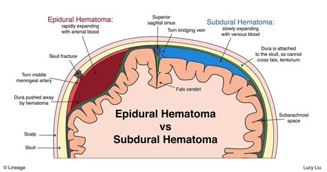 Head Trauma - Trauma - Orthobullets