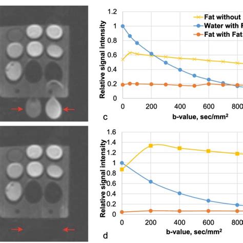 Four diffusion types: non-restricted, hindered, restricted with ...