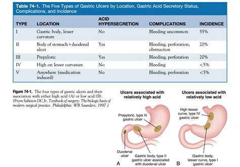 Johnson Classification Gastric Ulcer Colon Rectum | The Best Porn Website