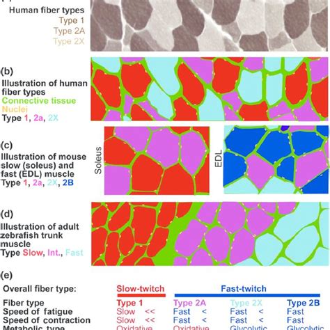 | Skeletal muscle fiber types. (a) Section of human muscle, where fiber ...