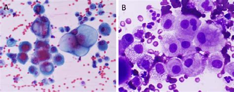 Mesothelial Cells