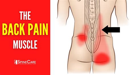 The Lower Back Pain Muscle (How to Release It for INSTANT RELIEF) - YouTube