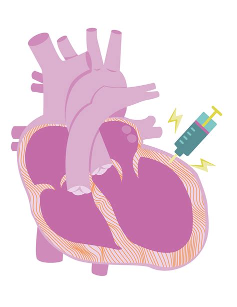 Module One: Understanding Your Diagnosis – myactioneducation.org