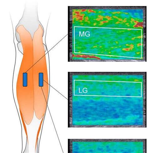 Muscling through: Linking muscle and joint stiffness of the lower human ...