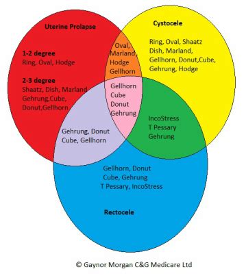 Pessary types - YOUR PESSARY