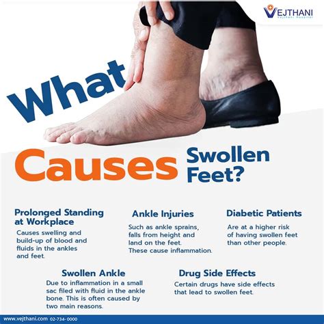 What Causes Swollen Feet?