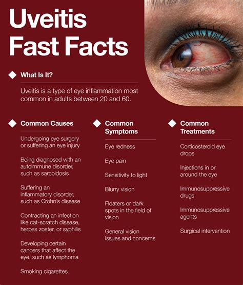 What Is Uveitis: Symptoms, Causes, Treatments – The Amino Company