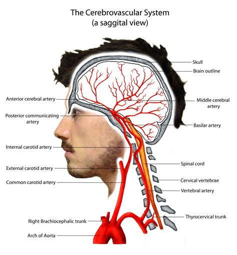 Pathophysiology | Arteries anatomy, Carotid artery, Vertebral artery