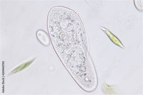 Ciliates Under Microscope