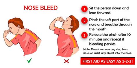 How To Control Nose Bleeds - Clockscheme Spmsoalan