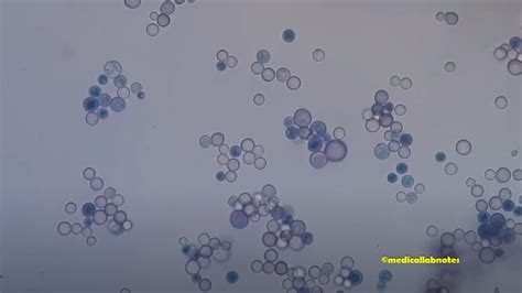 Methylene Blue Stain: Introduction, Principle, Composition, Preparation ...