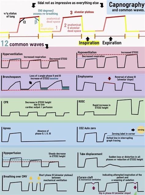 Capnography waveforms | Nurse anesthesia, Emergency nursing, Anesthesia ...