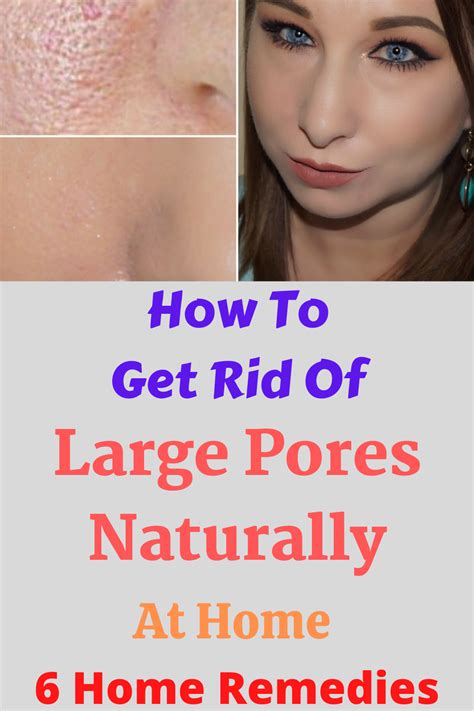 How To Get Rid Of Large Pores Naturally At Home - 6 Home Remedies ...