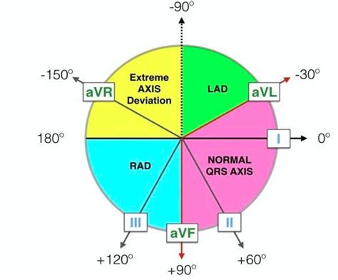 efektívna fragment kent calculating electrical axis ecg stojan hody Respond