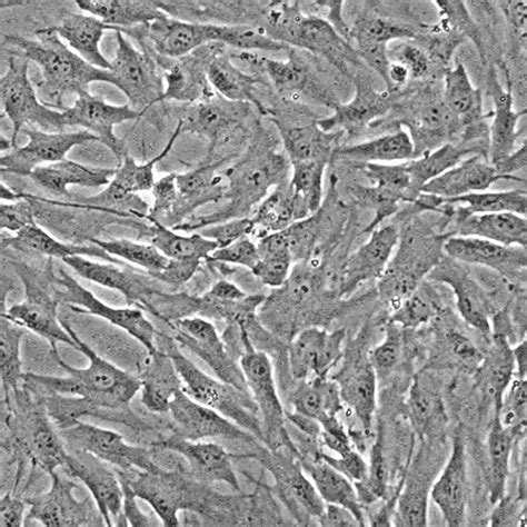 Human Nucleus Pulposus Cells - Innoprot Skeletal Cell System