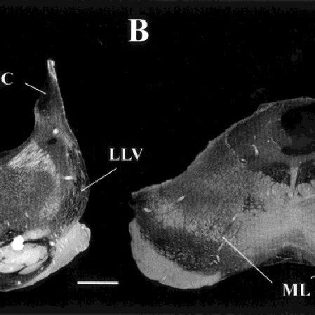 Novel retinal projections to the medial geniculate nucleus (MGN) after ...