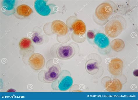 Pollen Grains of Different Species Under the Microscope Stock Photo ...