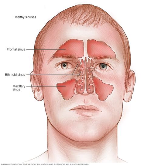 Acute sinusitis - Symptoms and causes - Mayo Clinic