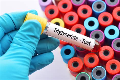 Why Are Your Triglycerides Low? Link to LDL & HDL Levels - SelfHacked