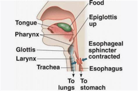 How To Dislodge Food Stuck In Esophagus | Renew Physical Therapy