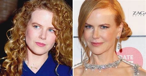 What Changes Did Nicole Kidman Make To Her Face?