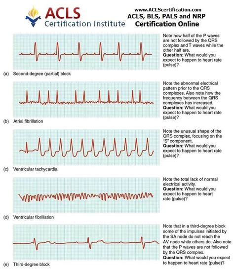 EKG. Who's naturally good at 'em? No one. It's learned and needs ...