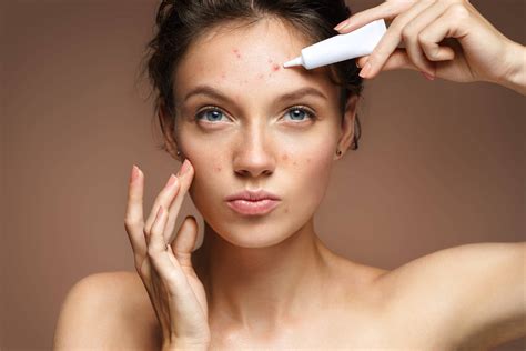 How Do Dermatologists Treat Acne? - Wellesley Dermatology Care