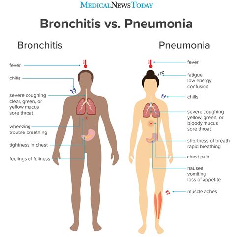 How To Cure Acute Bronchitis - Internaljapan9