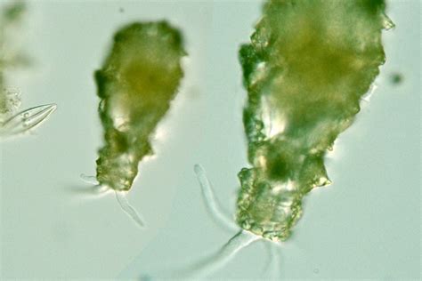 Protist Images: Difflugia oblonga