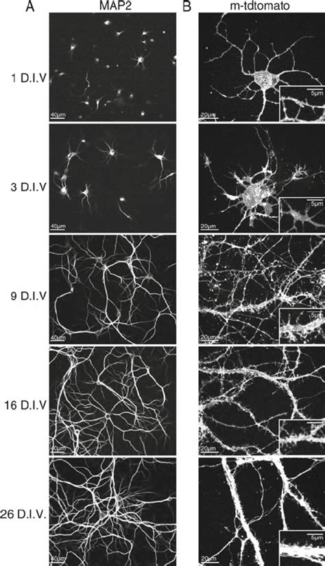 Development of dendrites and spines of postnatal hippocampal neurons ...