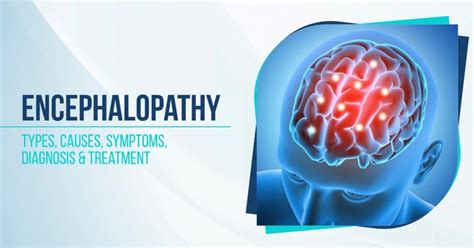 Encephalopathy: Types, Causes, Symptoms, Diagnosis & Treatment - GPSH ...