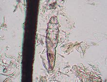 Demodex - Wiktionary, the free dictionary