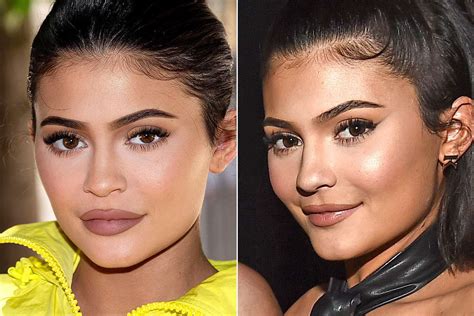 See Kylie Jenner's Filler-Free Lips