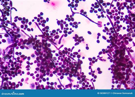 Budding Yeast Cells With Pseudohyphae From Sputum Gram Stain Tes Stock ...