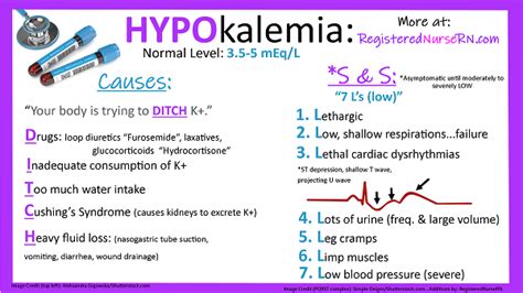 What Electrolyte Causes U Wave - cloudshareinfo