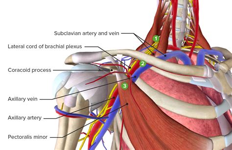 Thoracic Outlet Syndrome | Concise Medical Knowledge