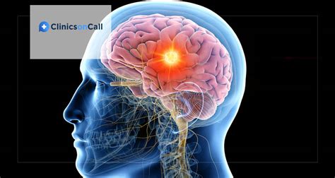 What are the symptoms & causes of craniopharyngioma ? - Clinics on Call