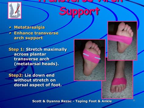 PPT - Therapeutic Taping for the Foot and Ankle PowerPoint Presentation ...