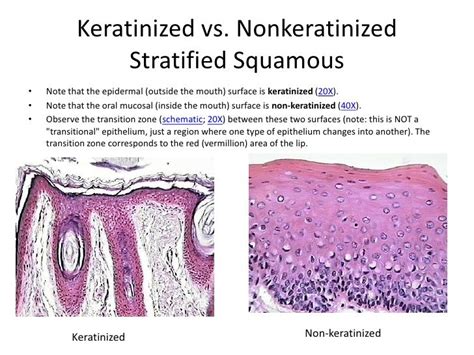 Non Keratinized Stratified Squamous Epithelium - JessieewaHenson