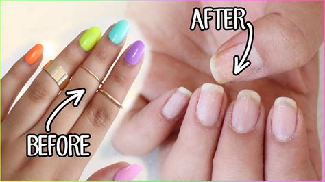 Hellomaphie: HOW TO REMOVE FAKE NAILS